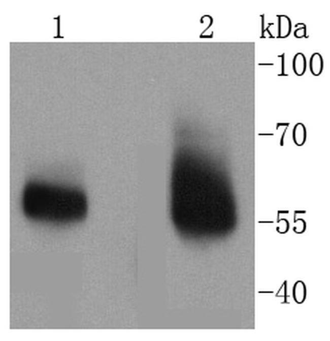 IRAK-M Antibody in Western Blot (WB)