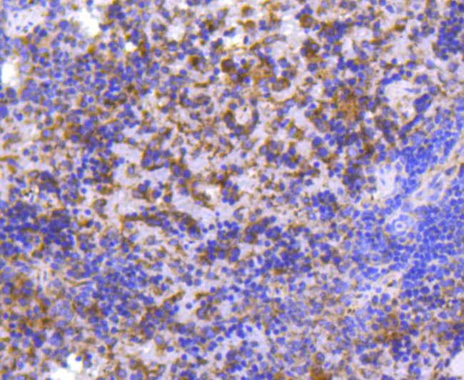 MMP11 Antibody in Immunohistochemistry (Paraffin) (IHC (P))