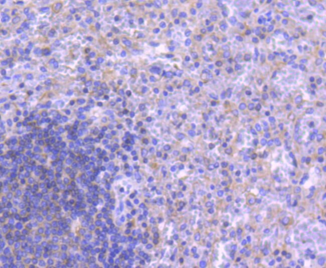 ATG5 Antibody in Immunohistochemistry (Paraffin) (IHC (P))