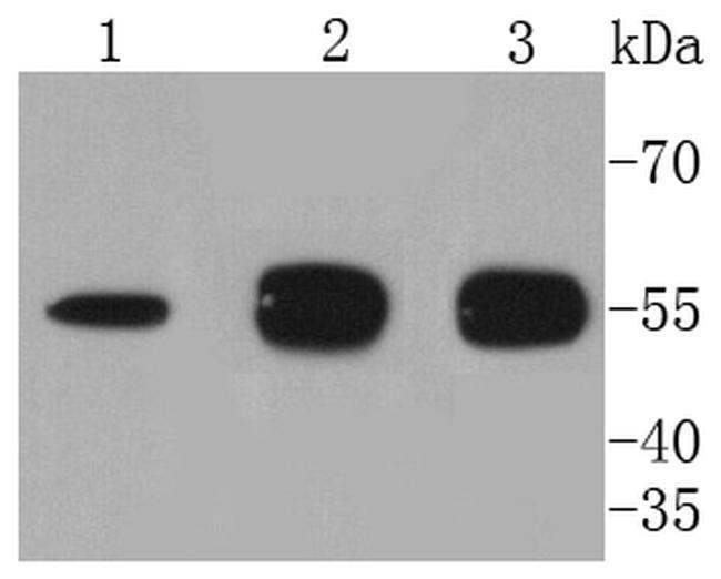 ATG5 Antibody in Western Blot (WB)