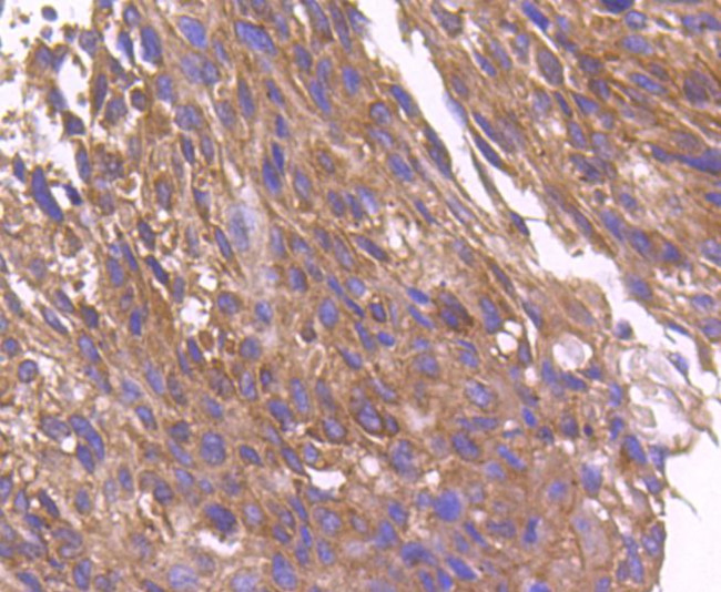 ARF1 Antibody in Immunohistochemistry (Paraffin) (IHC (P))