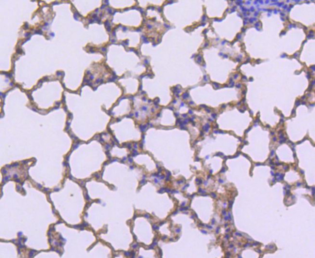 S100A4 Antibody in Immunohistochemistry (Paraffin) (IHC (P))