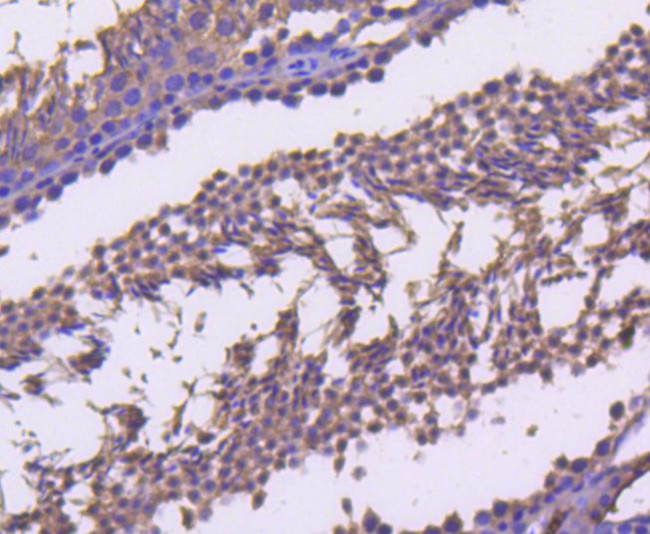 Cyclin B2 Antibody in Immunohistochemistry (Paraffin) (IHC (P))