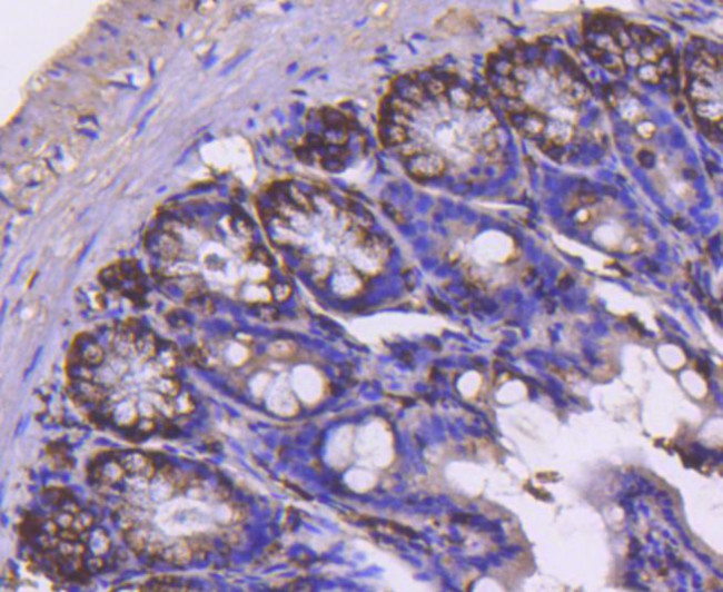 Cyclin B2 Antibody in Immunohistochemistry (Paraffin) (IHC (P))