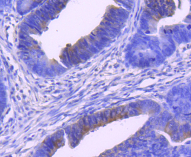 Phospho-MEK1 (Ser298) Antibody in Immunohistochemistry (Paraffin) (IHC (P))