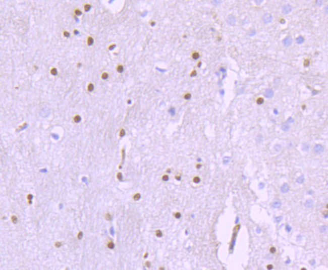 SOX10 Antibody in Immunohistochemistry (Paraffin) (IHC (P))