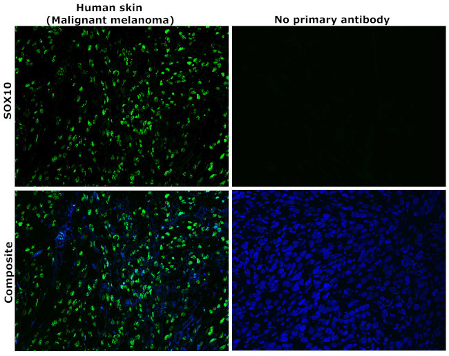 SOX10 Antibody in Immunohistochemistry (Paraffin) (IHC (P))