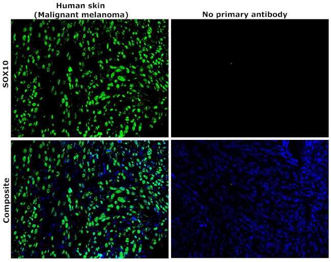 SOX10 Antibody in Immunohistochemistry (Paraffin) (IHC (P))