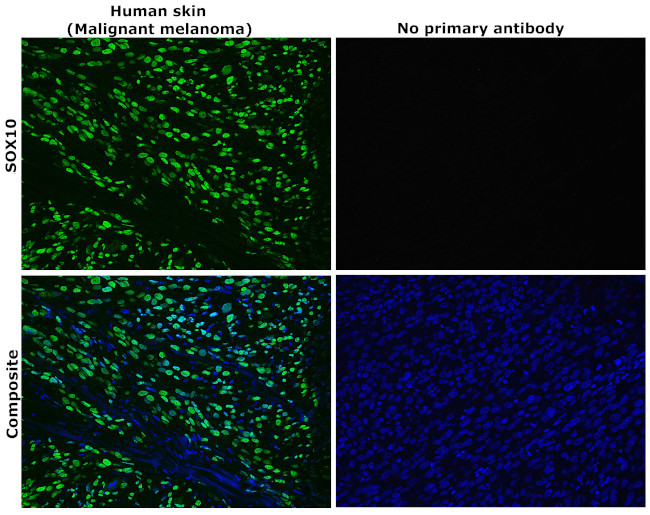 SOX10 Antibody in Immunohistochemistry (Paraffin) (IHC (P))