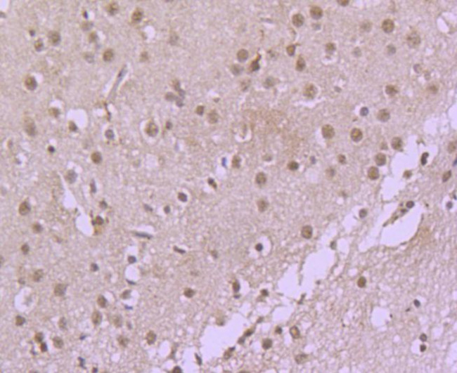 Cdc40 Antibody in Immunohistochemistry (Paraffin) (IHC (P))