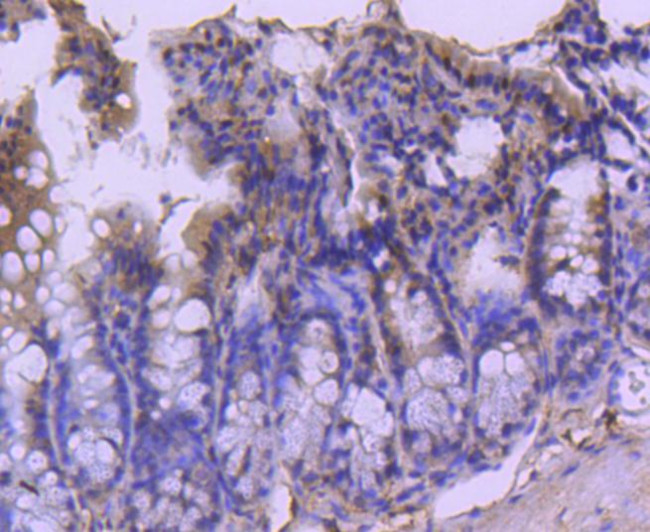 Cdc40 Antibody in Immunohistochemistry (Paraffin) (IHC (P))