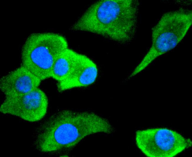 Cdc34 Antibody in Immunocytochemistry (ICC/IF)