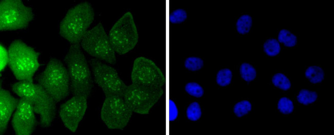 Caspase 14 Antibody in Immunocytochemistry (ICC/IF)