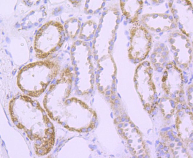 SOD2 (MnSOD) Antibody in Immunohistochemistry (Paraffin) (IHC (P))