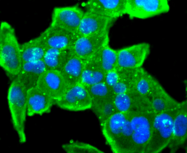 CD3d Antibody in Immunocytochemistry (ICC/IF)