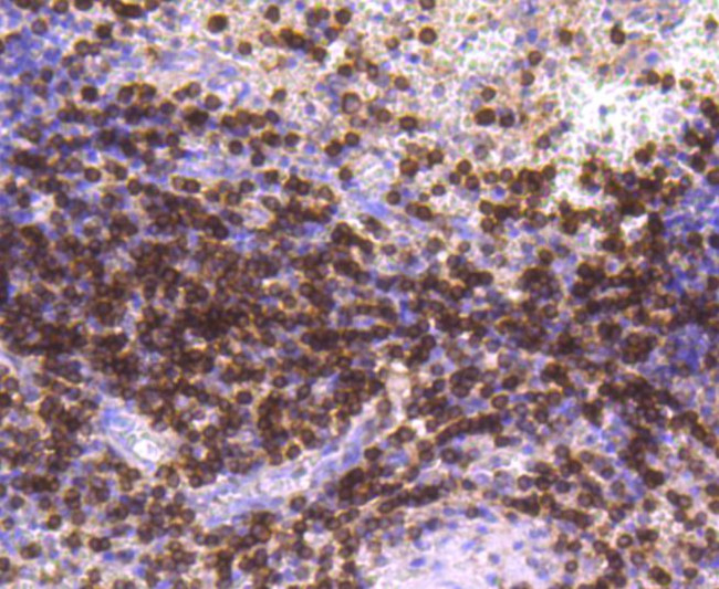 CD3d Antibody in Immunohistochemistry (Paraffin) (IHC (P))