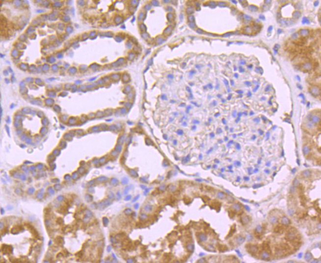 CD3d Antibody in Immunohistochemistry (Paraffin) (IHC (P))