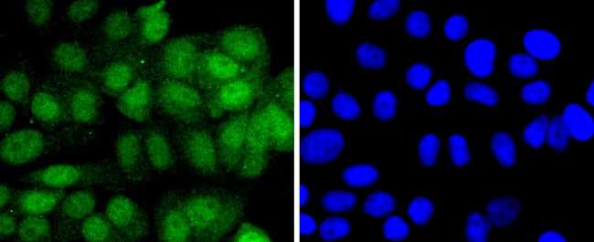 4EBP1 Antibody in Immunocytochemistry (ICC/IF)