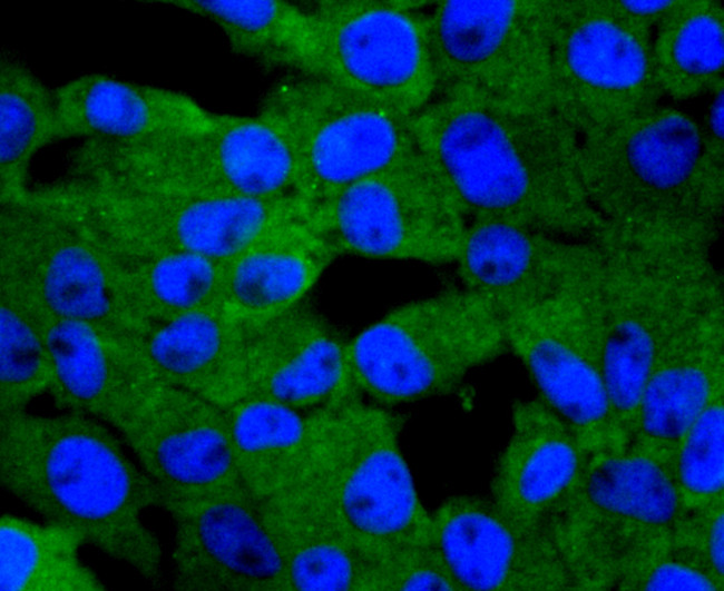 PKC delta Antibody in Immunocytochemistry (ICC/IF)