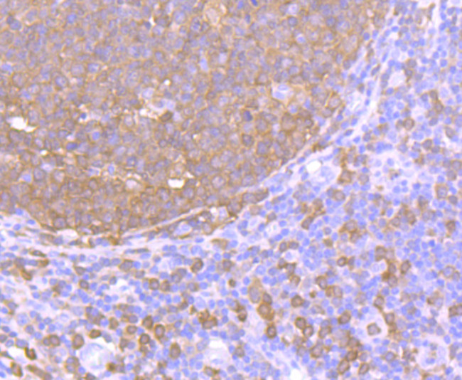 PKC delta Antibody in Immunohistochemistry (Paraffin) (IHC (P))