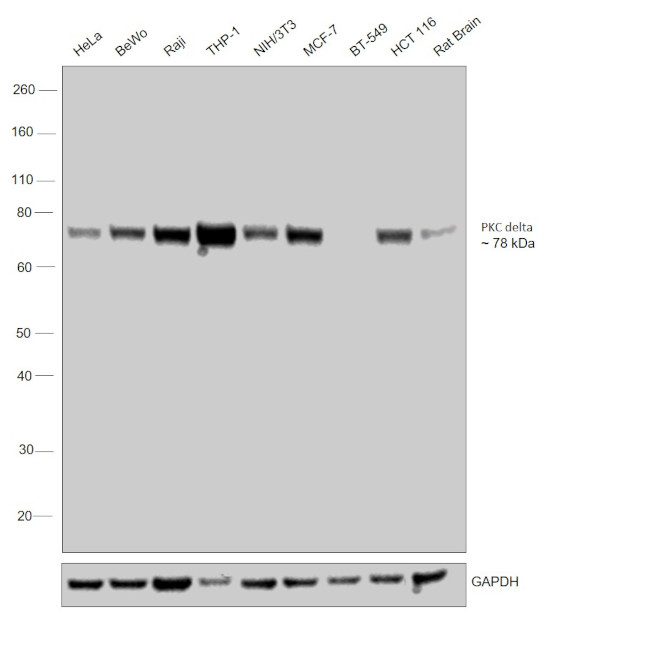 PKC delta Recombinant Monoclonal Antibody (JJ093-02) (MA5-32482)