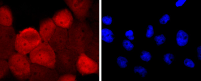 S100A6 Antibody in Immunocytochemistry (ICC/IF)