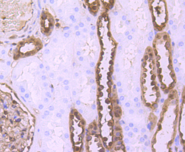 S100A6 Antibody in Immunohistochemistry (Paraffin) (IHC (P))