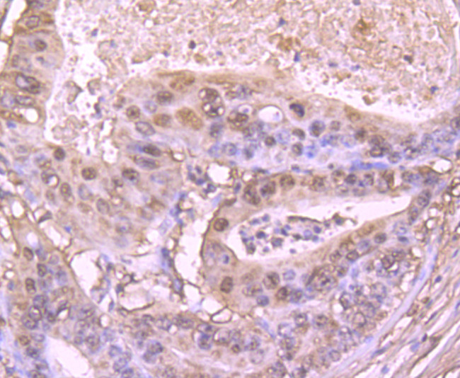 S100A6 Antibody in Immunohistochemistry (Paraffin) (IHC (P))