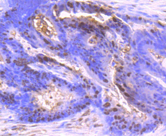 S100A6 Antibody in Immunohistochemistry (Paraffin) (IHC (P))