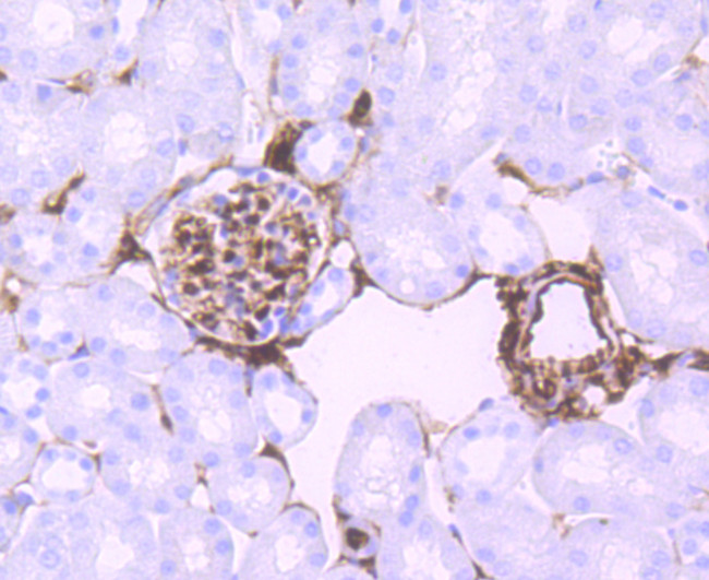 S100A6 Antibody in Immunohistochemistry (Paraffin) (IHC (P))