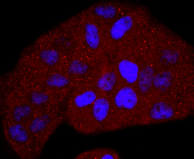 TK1 Antibody in Immunocytochemistry (ICC/IF)