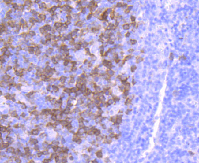 TK1 Antibody in Immunohistochemistry (Paraffin) (IHC (P))