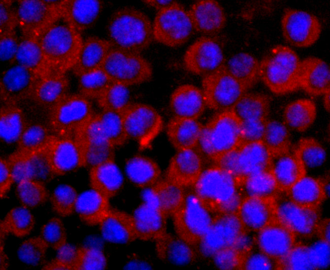 CNPase Antibody in Immunocytochemistry (ICC/IF)