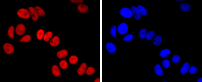 FOXA1 Antibody in Immunocytochemistry (ICC/IF)