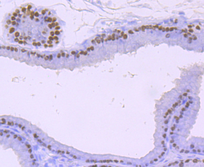 FOXA1 Antibody in Immunohistochemistry (Paraffin) (IHC (P))