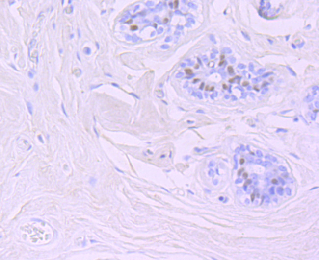 FOXA1 Antibody in Immunohistochemistry (Paraffin) (IHC (P))