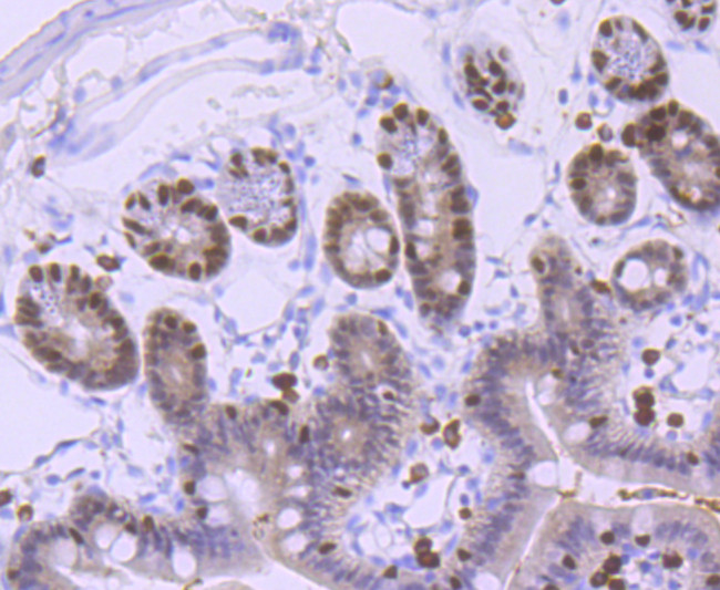 FOXA1 Antibody in Immunohistochemistry (Paraffin) (IHC (P))