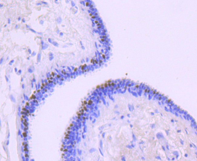 FOXA1 Antibody in Immunohistochemistry (Paraffin) (IHC (P))