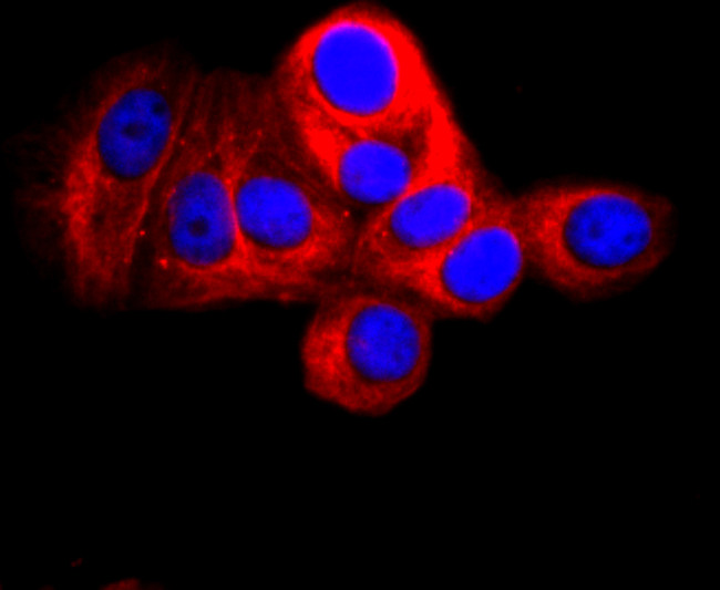 CD90 (Thy-1) Antibody in Immunocytochemistry (ICC/IF)