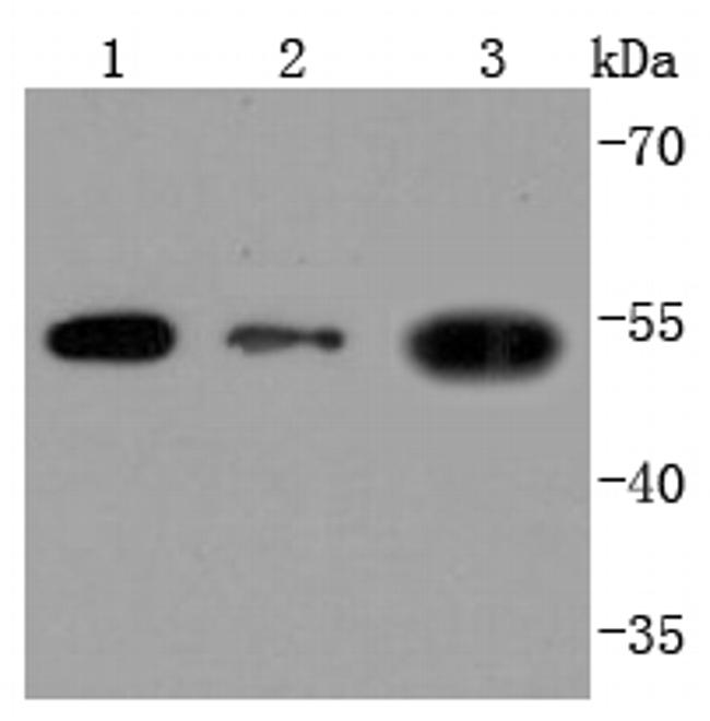 CD90 (Thy-1) Antibody in Western Blot (WB)