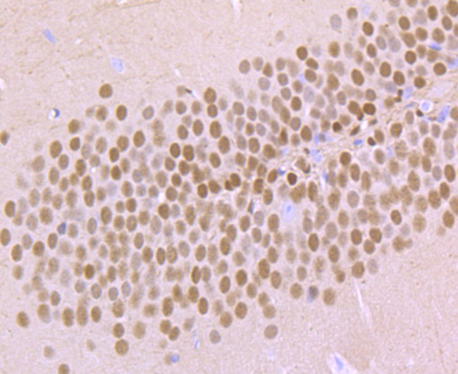 TBR1 Antibody in Immunohistochemistry (Paraffin) (IHC (P))