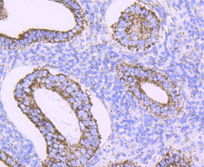 ATP Synthase beta Antibody in Immunohistochemistry (Paraffin) (IHC (P))