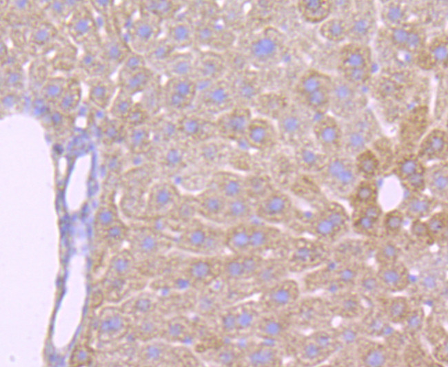 ATP Synthase beta Antibody in Immunohistochemistry (Paraffin) (IHC (P))