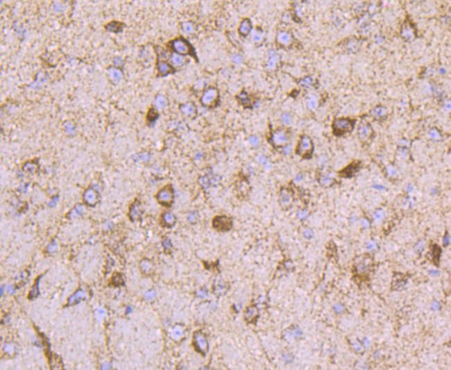 ATP Synthase beta Antibody in Immunohistochemistry (Paraffin) (IHC (P))