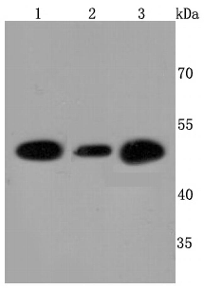 ATP Synthase beta Antibody in Western Blot (WB)