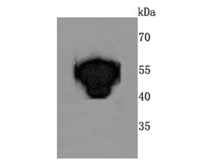 ATP Synthase beta Antibody in Western Blot (WB)