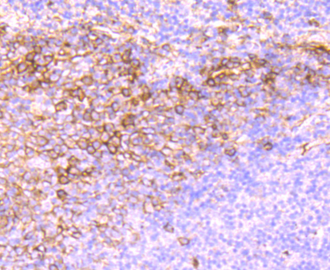 CD138 Antibody in Immunohistochemistry (Paraffin) (IHC (P))