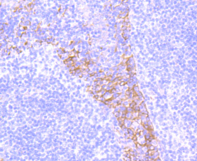 CD104 (Integrin beta 4) Antibody in Immunohistochemistry (Paraffin) (IHC (P))