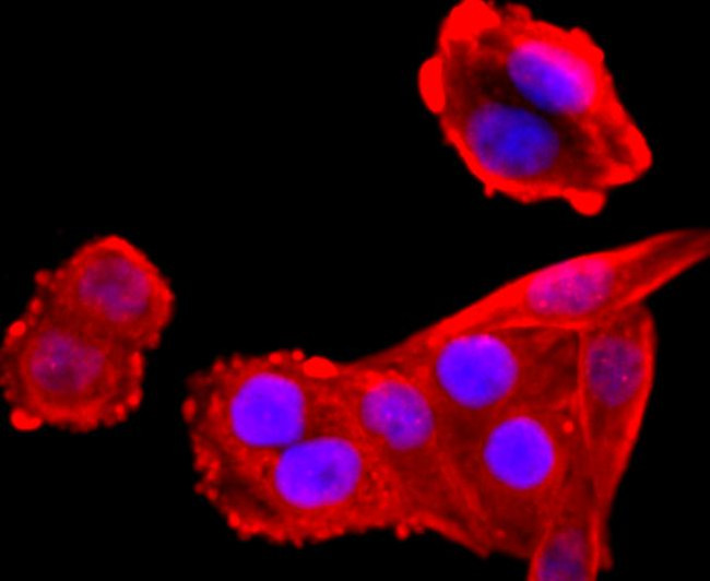 VCP Antibody in Immunocytochemistry (ICC/IF)