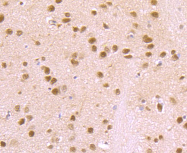 VCP Antibody in Immunohistochemistry (Paraffin) (IHC (P))